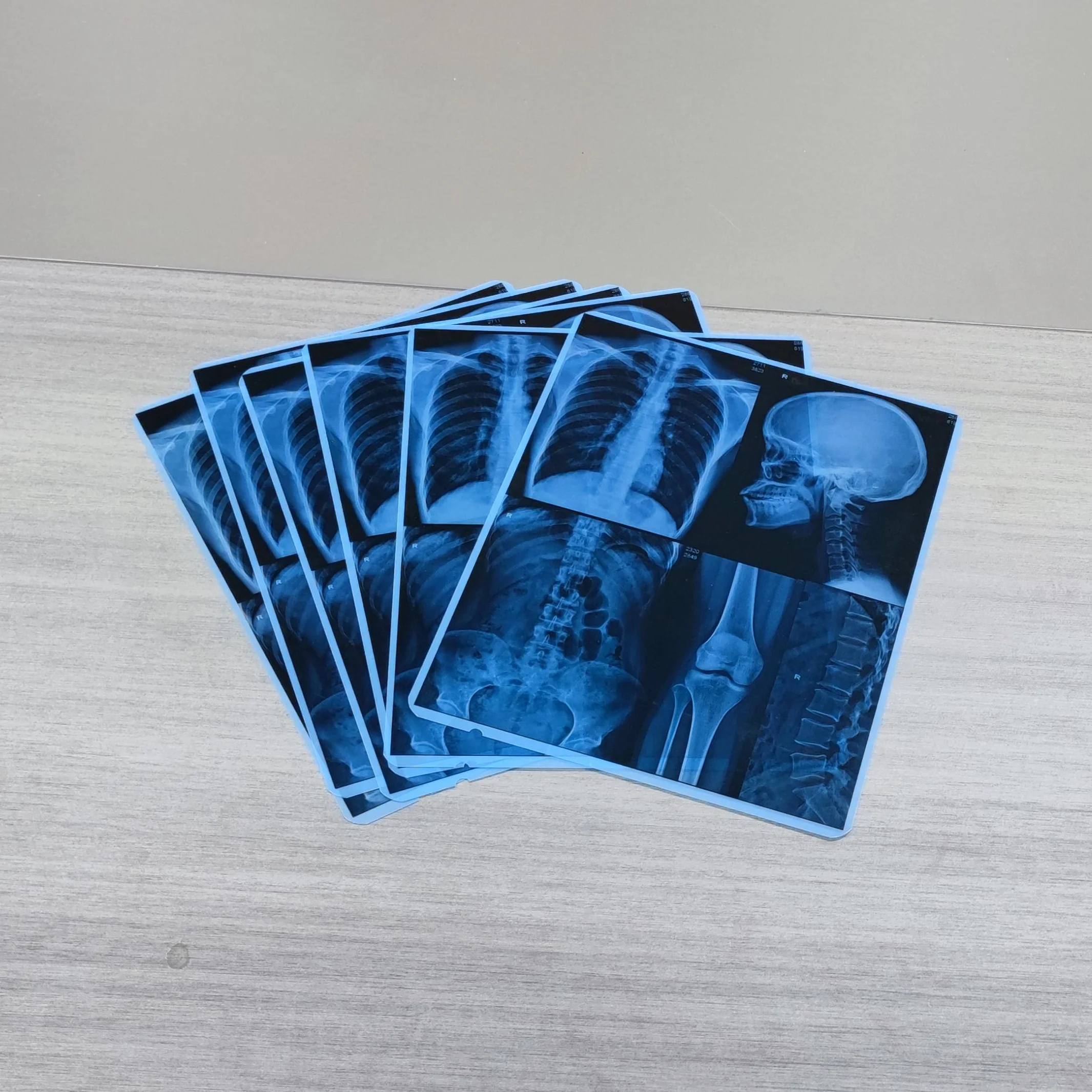 CT scan Medical x ray thermal film for fuji DI-HL Drypix imaging printer
