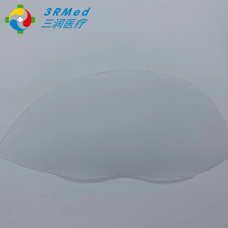 Одноразовая грыжная сетка 3D Max pp