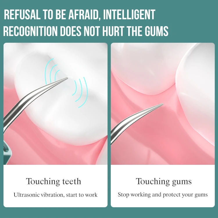 2024 Jssan New Dental Visible Electric Sonic Tooth Cleaner Smart APP Plaque Calculus Remover Oral Camera