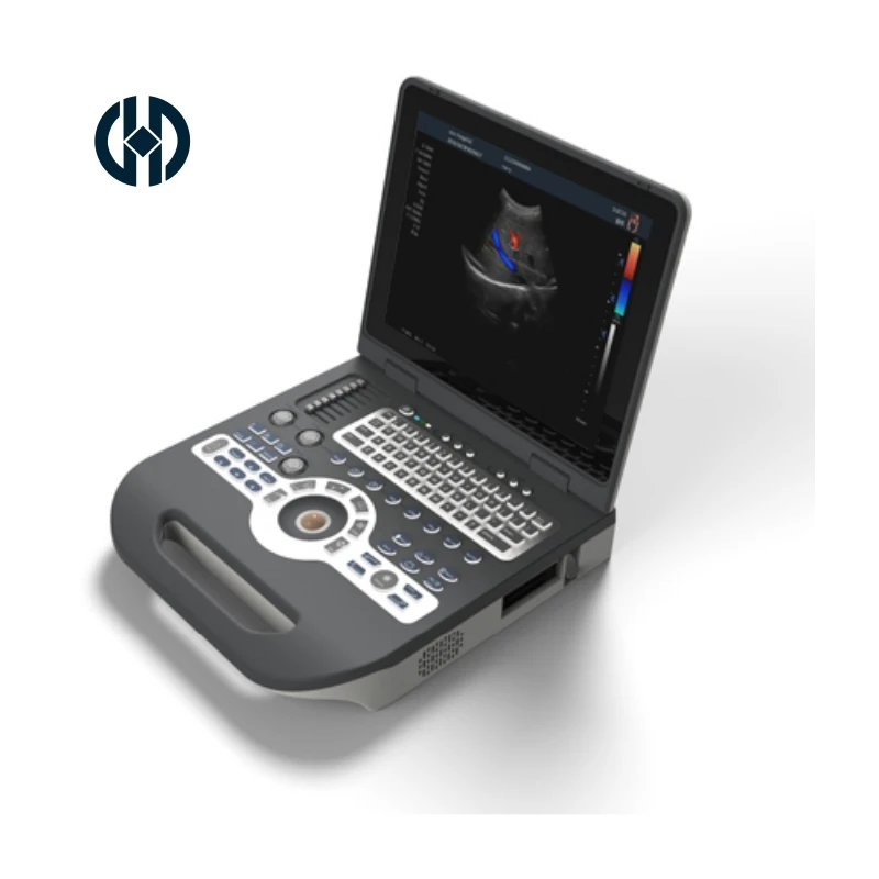 15 inch diagnostic ultrasound scanner ultrasound machine portable for ob echocardiogram musculoskeletal human medical