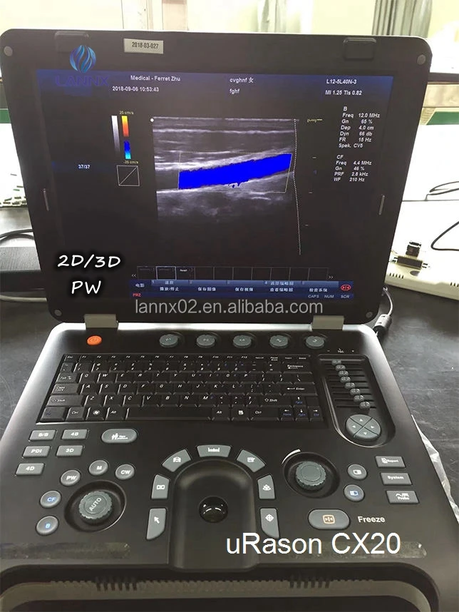 LANNX uRason CX20 In Stock product Laptop scanner ultrasonido ecografo sonography machine 2D/3D Color Doppler Ultrasound