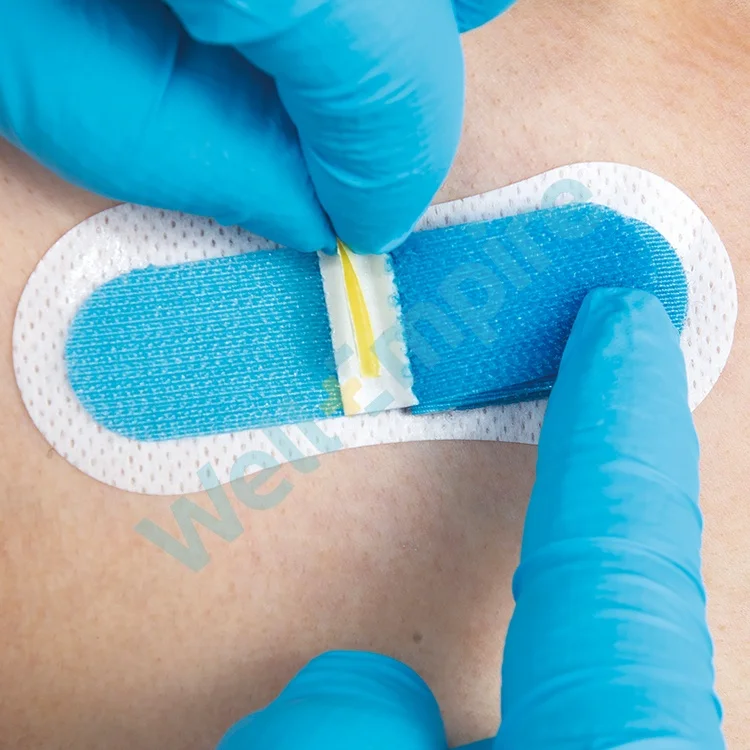 
G7 Foley Dressing Epidural Methods Umbilical Catheter Fixation 