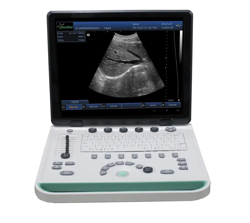 
 ПК на базе 3D ультразвуковая машина SS-9 ноутбук ультразвуковой сканер  