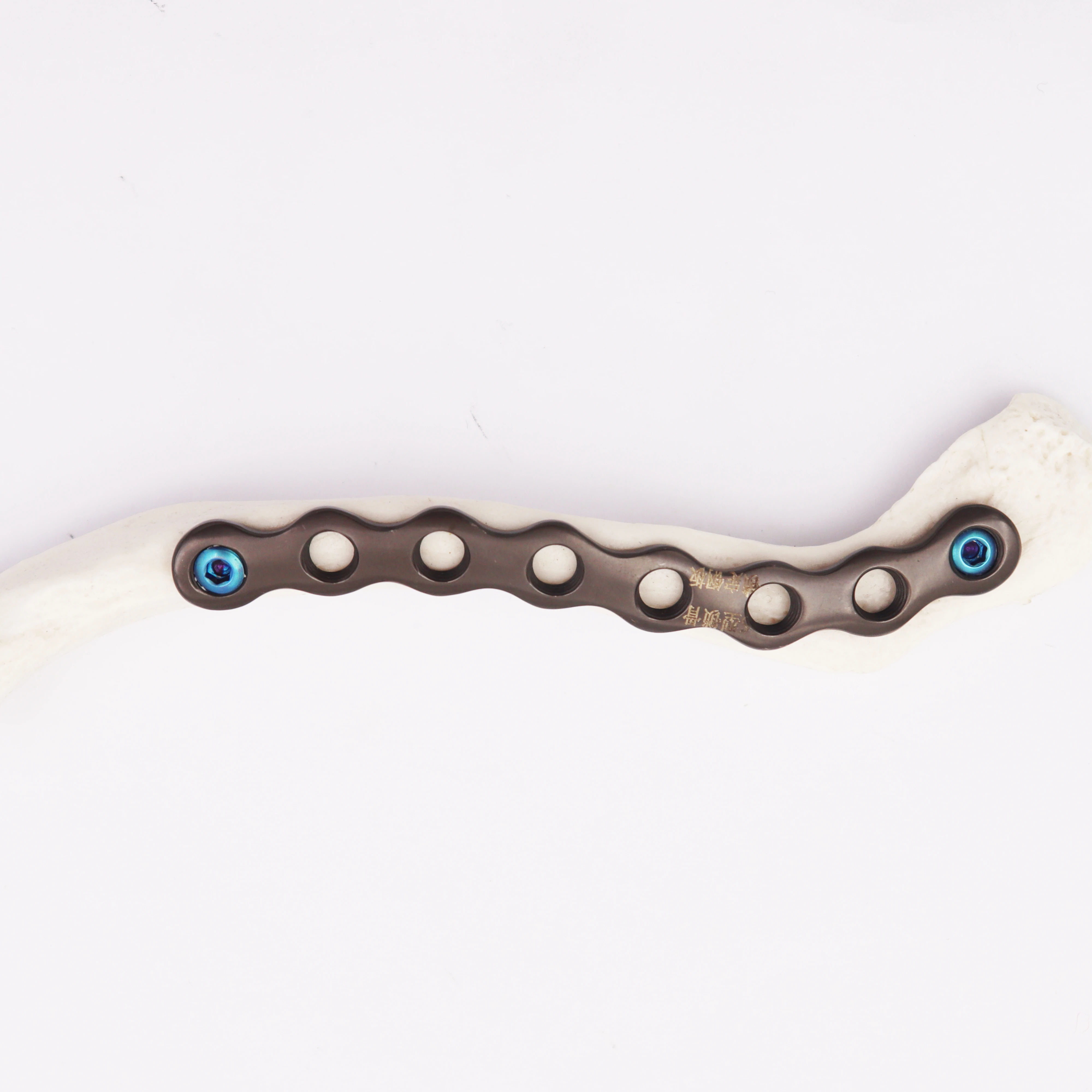 medical surgery orthopedic implants Clavicle Locking Plate of S type