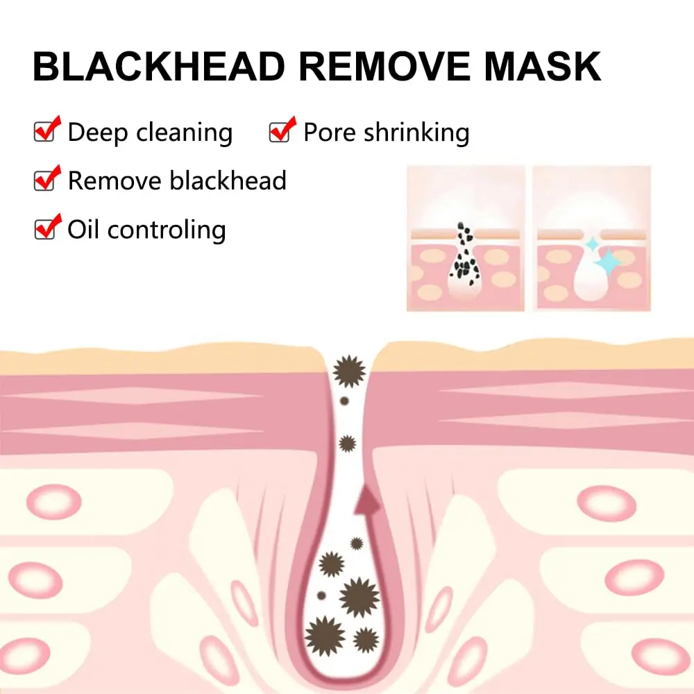 OEM ODM Bamboo charcoal Black Head Remover With Chamomile Extract Deep Tighten And Cleansing Pore Facial Mask Reduce Black Head
