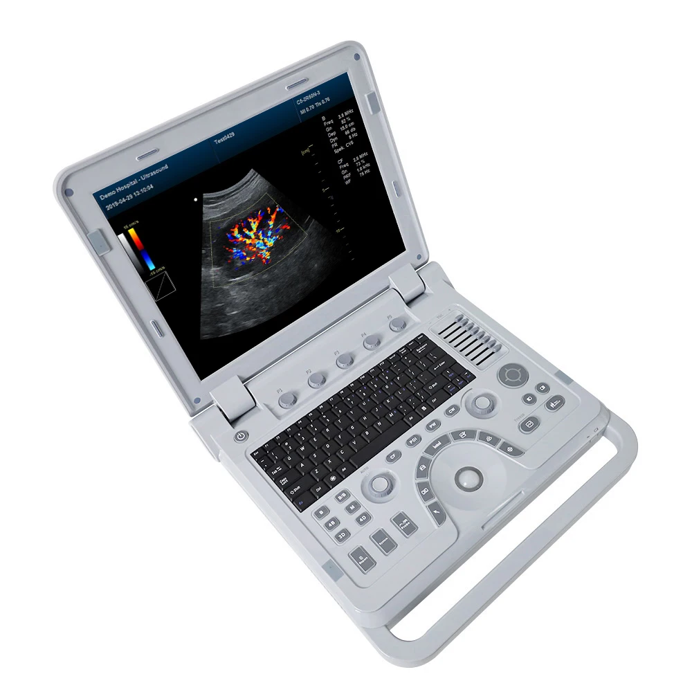 CONTEC CMS1700A VET Sonography veterinary Echocardiography Vascular Ultrasound color doppler