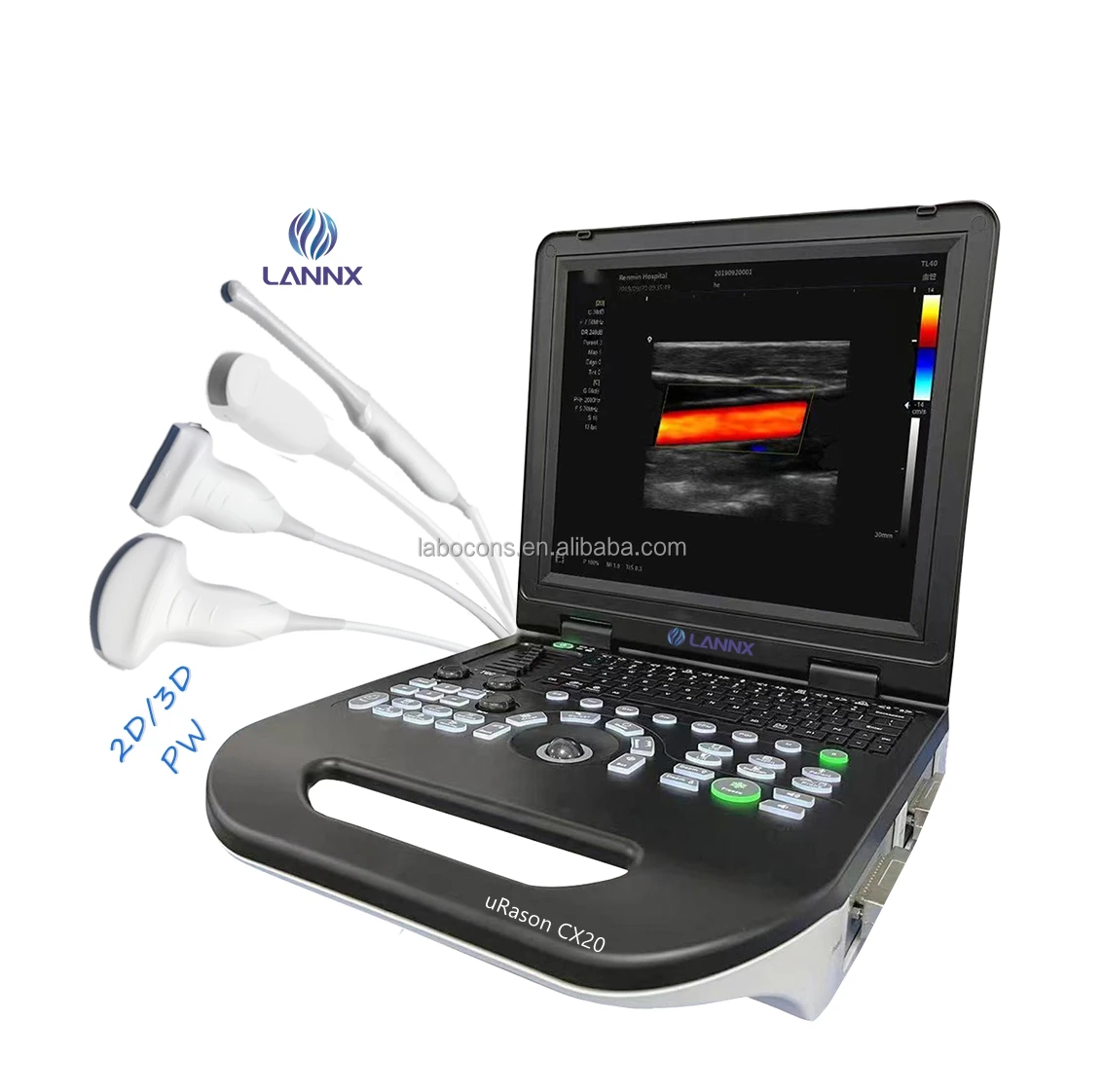 LANNX uRason CX20 Best Price Portable Ultrasound System Color Doppler echographie full Digital 2d ultrasound for pregnancy