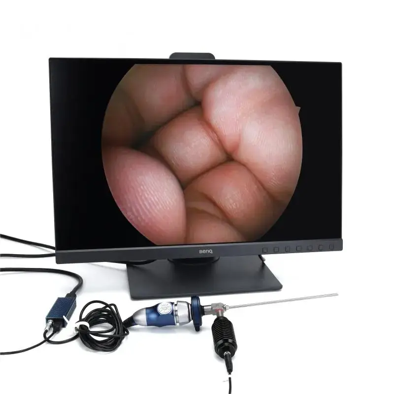 Full HD 1080p endoscope camera for ENT surgery with USB cable
