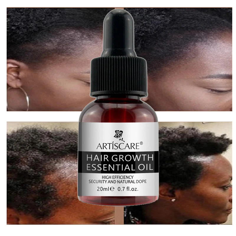 Private Label Herbal Painless Hair Care Serum Anti Hair Loss Treatment Fast Growing Germinal Hair Serum