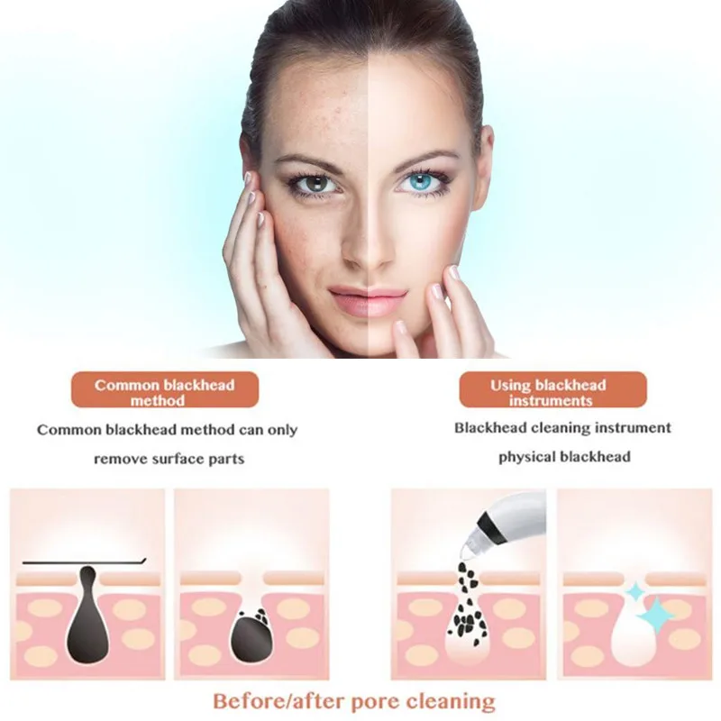 BINZIM Spa micro blackhead remover skin diamond dermabrasion home used comedo suction beauty machine