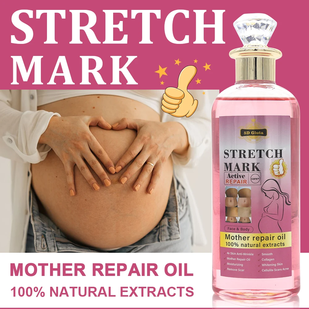 Natural Extracts Stretch Marks removal oil cream products Treatment Repair Scar Postpartum Repair Firming Body Stretch Marks Oil