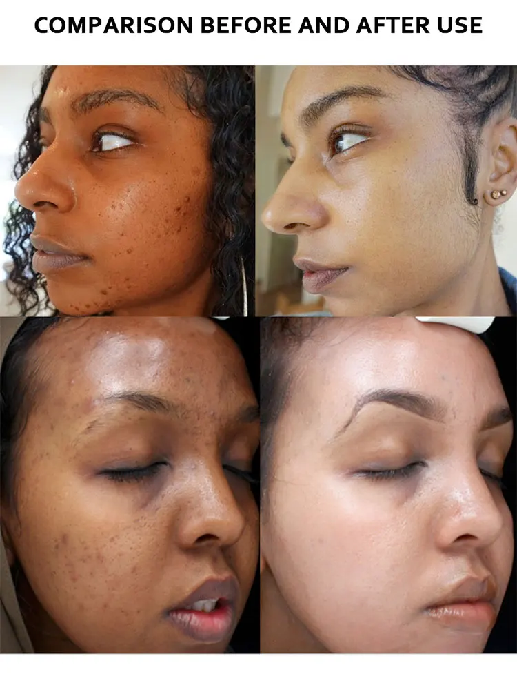 5D Gluta Skin Whitening capsules Glutathione Capsule With Collagen Pill Tablets