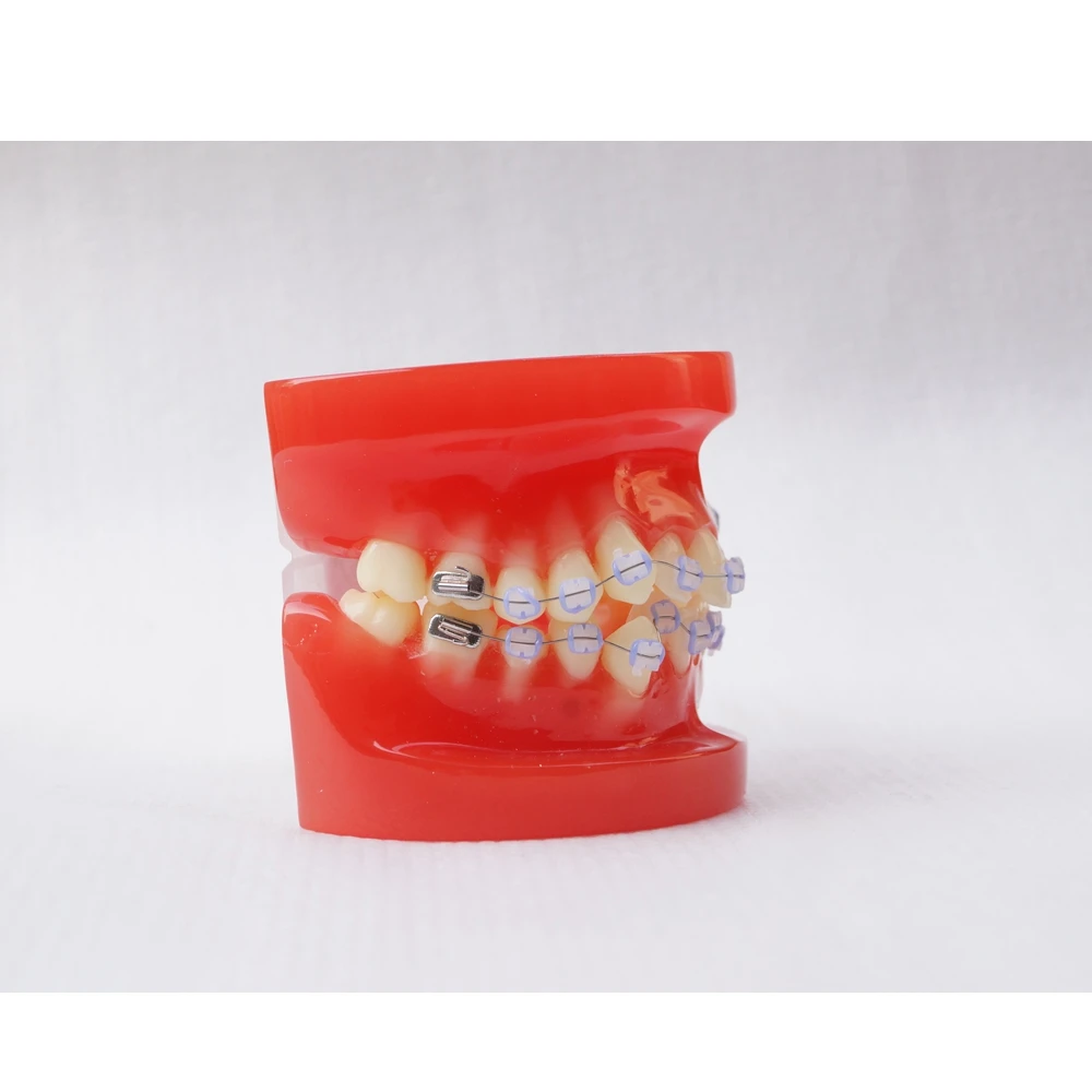 Dental Orthodontic Teeth Study Model 28 Teeth with Ceramic Bracket