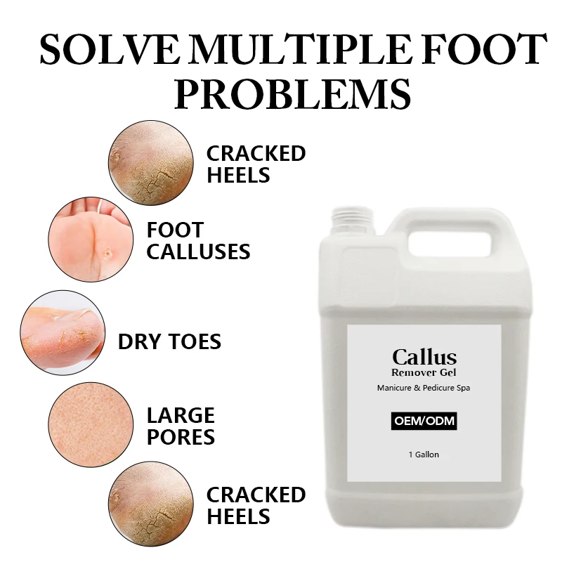 Wholesale Customized Remove Calluses Corns Gel Para Eliminar Callos Callus Remover Pedi Gel 1 Gallon For Feet