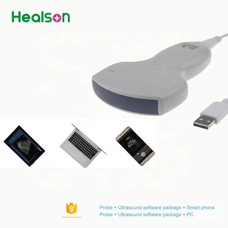
Healson UP20 cheapest USB portable ultrasound machine /usb ultrasound probe 