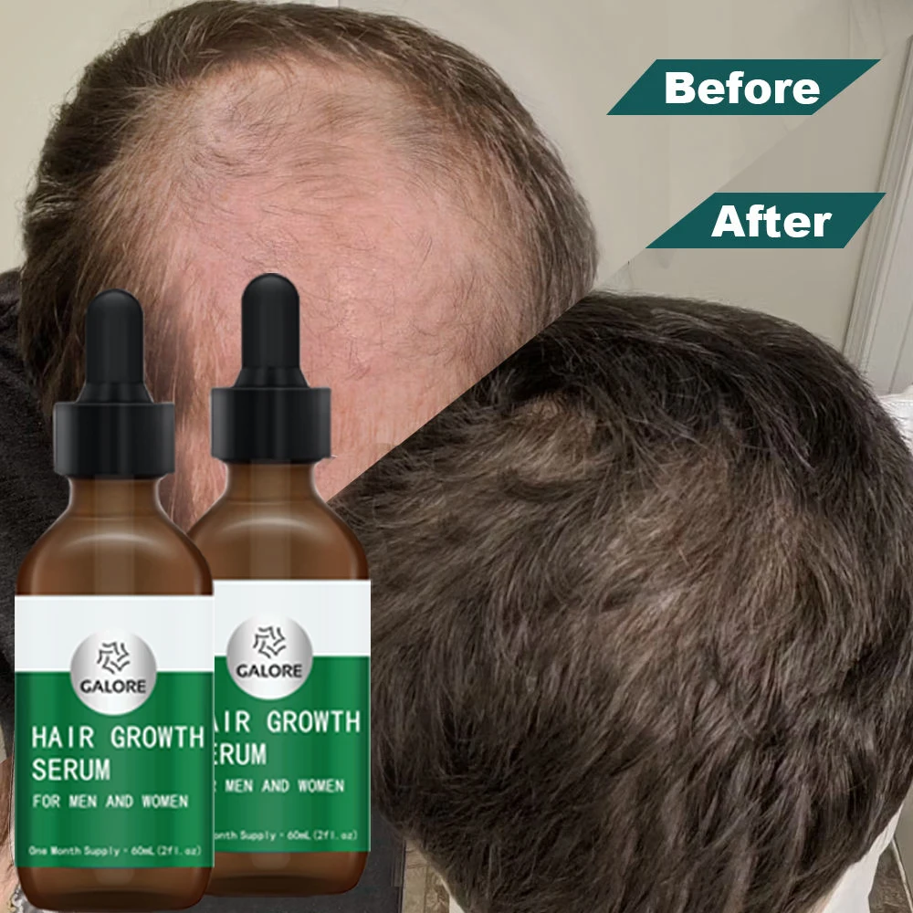 100% Natural   Hair Growth Serum Private Label mix herbs  Oil for Men and Women