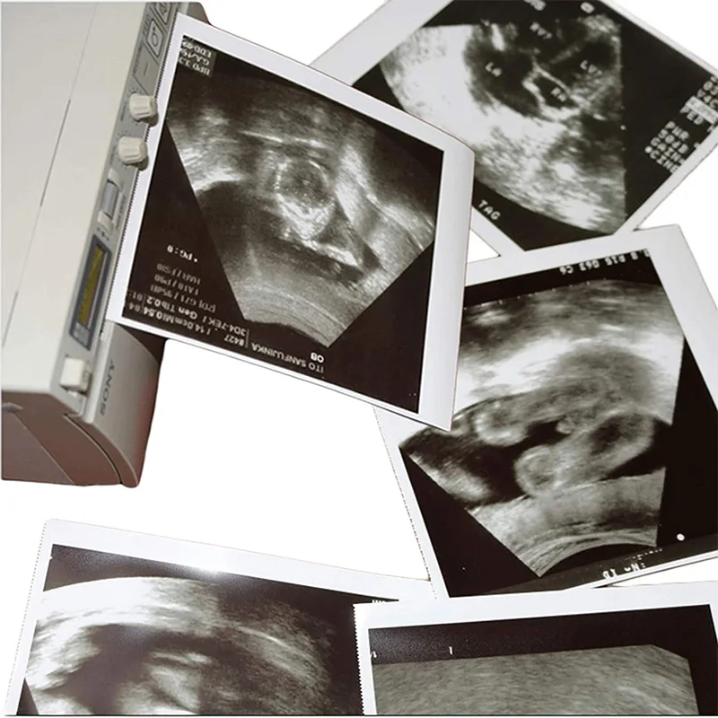 UPP 110S термоультразвуковая бумага в рулонах типа I Матовая Белая медицинская видеопечать