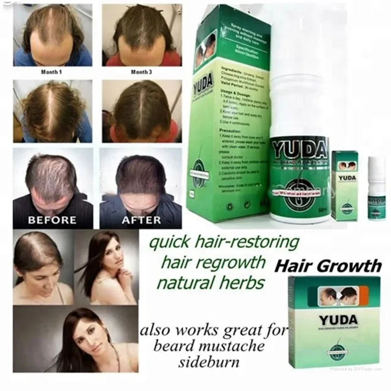 100% original  YUDA Pilatory hair growth spray for Fast Hair regrowth
