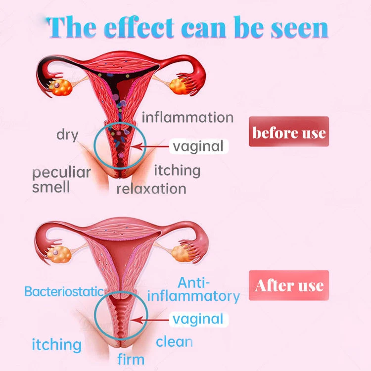 Оптовая продажа индивидуальные 3 года 100% натуральная травяная частная капсула Yoni вагинальная сжимаемая