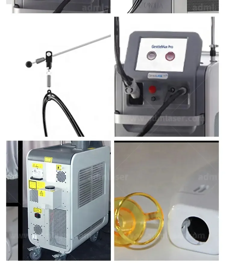 New Trending 1064 755nm Alex Laser Fiber Long Pulse Nd Yag Laser alexandrite laser hair removal/ Alexandrite Equipment