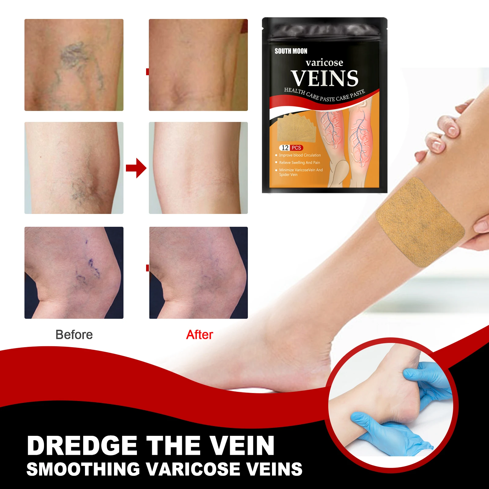 Hot Sale South Moon Brand Varicose Veins Health Care Paste Vein Soothing Leg Strengthen Capillary