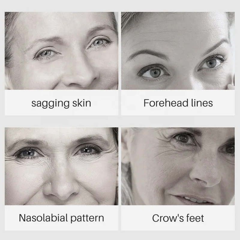 Best selling private label 30ml skin care serum anti acne moisturizing lightening facial turmeric serum for acne skin