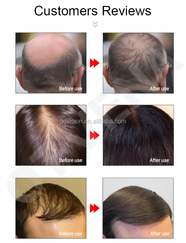 Organic Products See Results In 30 Days Castor Oil Hair Oil For Hair Growth