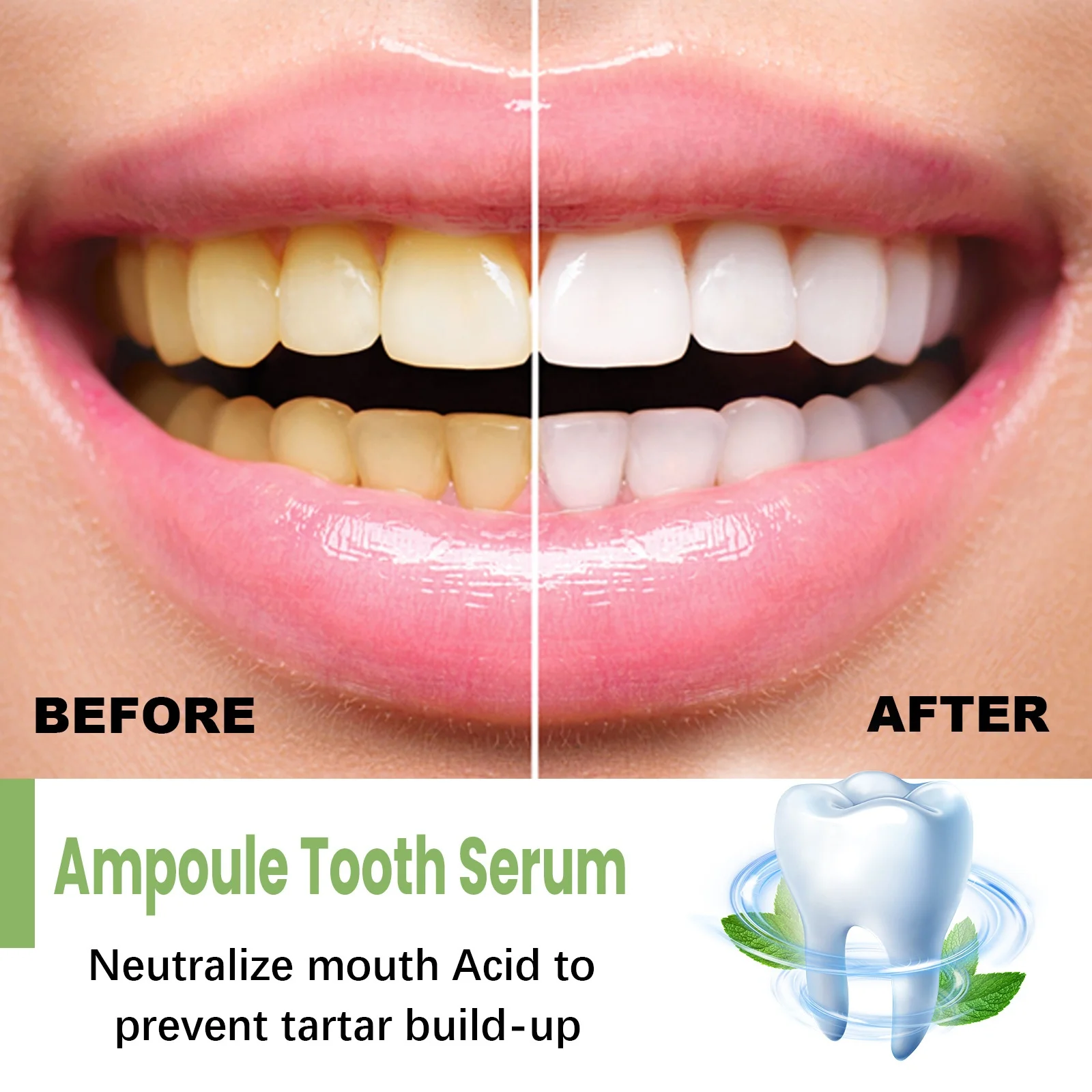 New Hot Selling Oral Product Anti-cavity Anti-bacterial Dental Care Whitening Teeth Color Corrector Tooth Serum