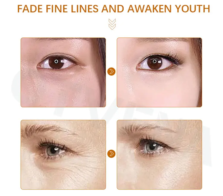 Copper peptide Retinol vitamin C E hyaluronic acid anti aging wrinkle Cream