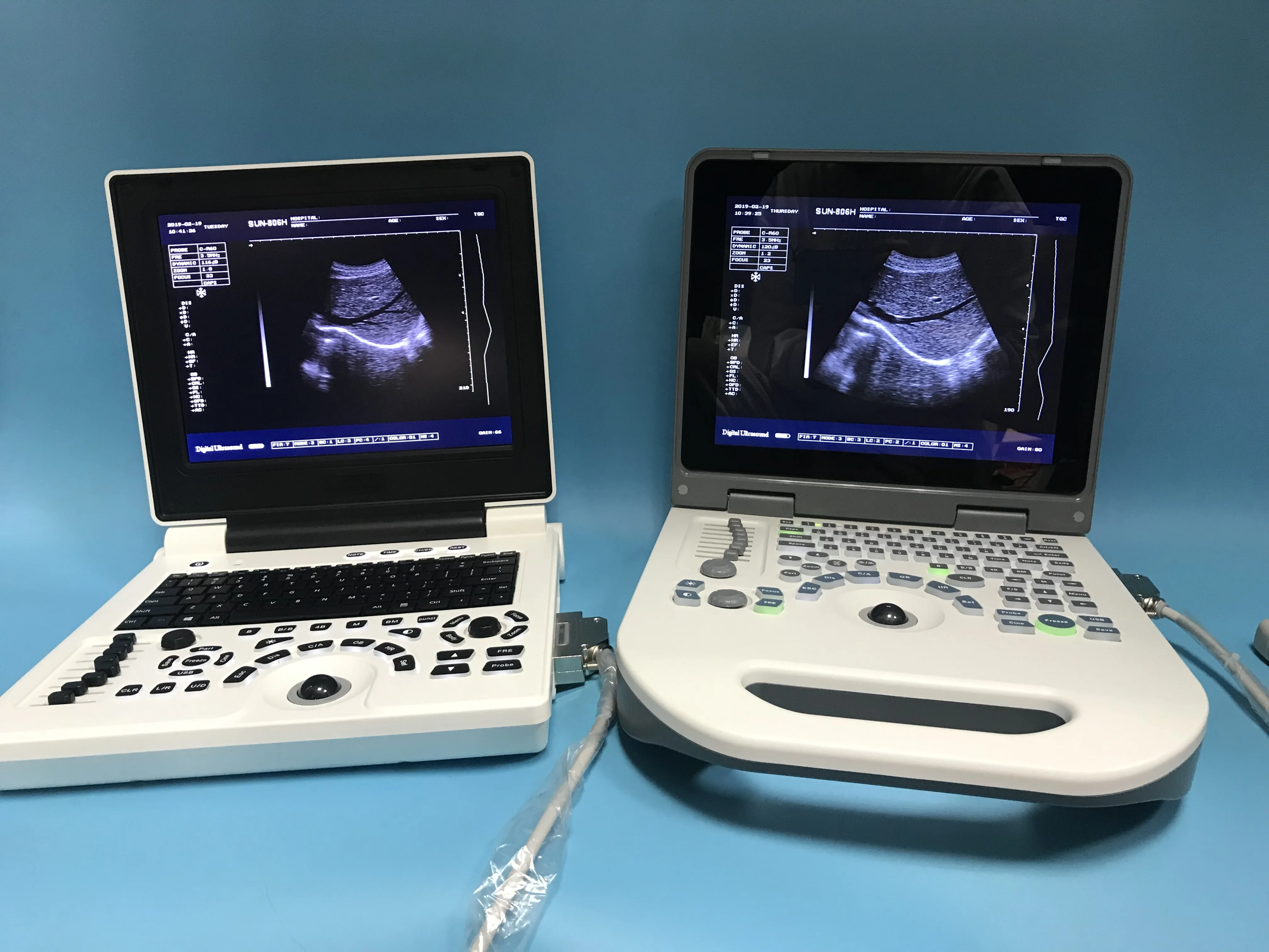 CE certified medical portable ultrasound machine with musculoskeletal newest linear ultrasound system
