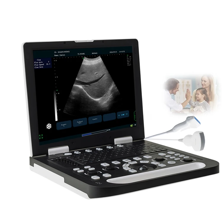 Ultrasound Diagnostic System Phased Array Cardiac Imaging Technology B/W Ultrasonido Machine