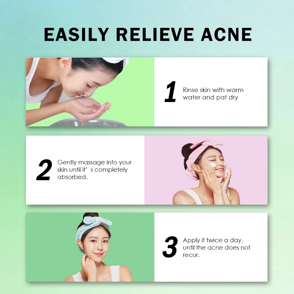 GMP Organic Acne Treatment Acne Deep Scar Removal Face Cream Female Skin Lightening Dark Sport Corrector Kinds Skin Care Adults