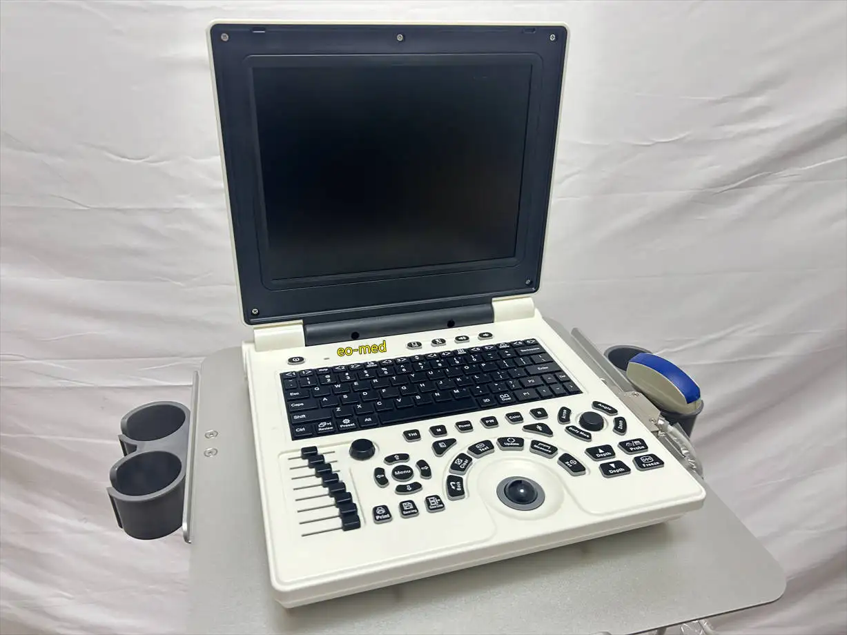 Medical Supplies High Quality Fully Digital Portable Ultrasound Scanner Ultrasound Scanning Machine BW20