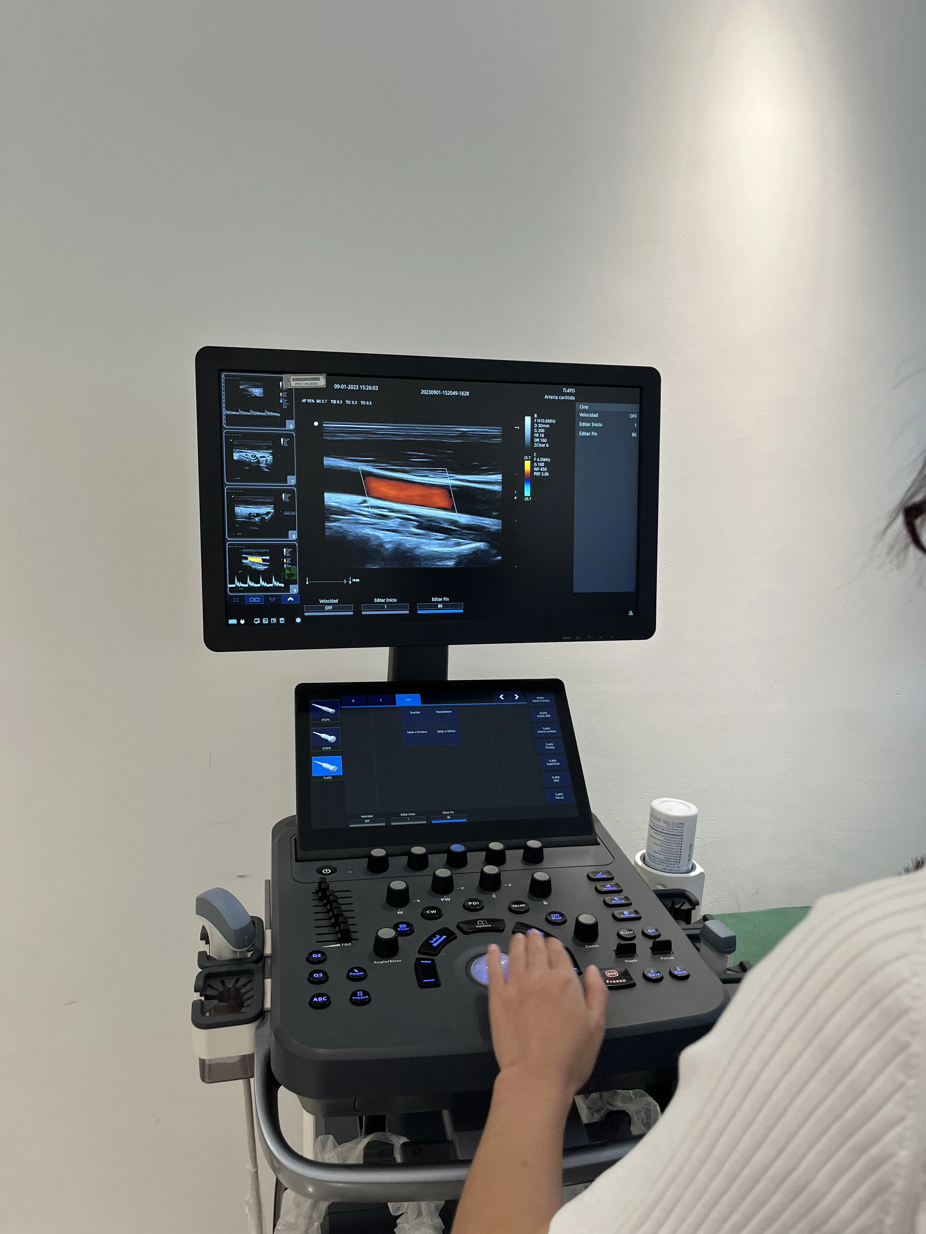 LTUB72 Medical Equipment Ultrasound Probe Scanner 21Inches Full Digital Color Doppler Ultrasound Scanner