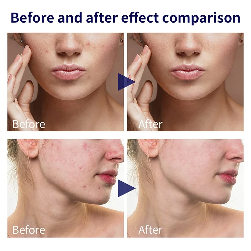 Wholesale 30ml Organic Face Skin Care Corrector Serum Clearly Corrective Dark Spot Solution