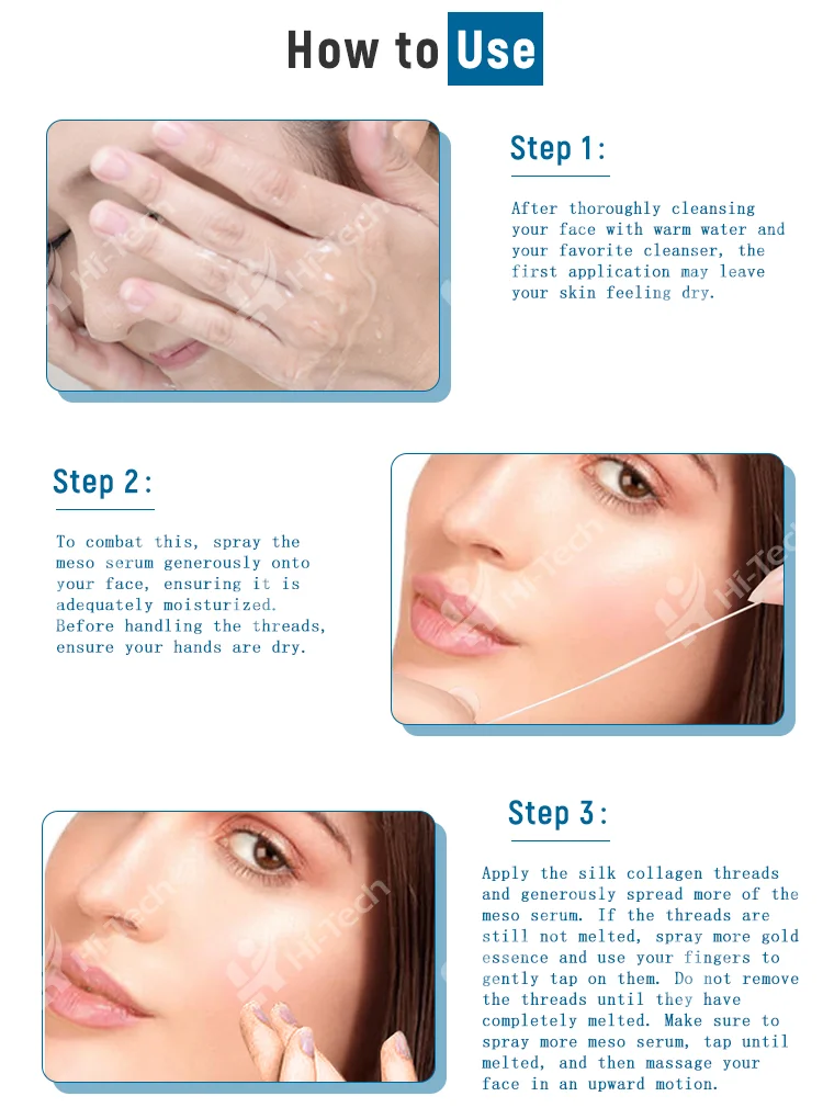 PDO Ultra V-lift Thread Improve Aging Skin With Non-surgical Thread Lift