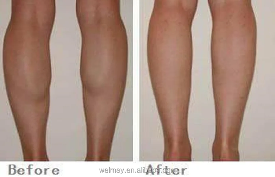 Portable 28 Channels Lymphatic Drainage Pressotherapy Balancer Sport Body Slimming Pressotherapy Air Compression Portable