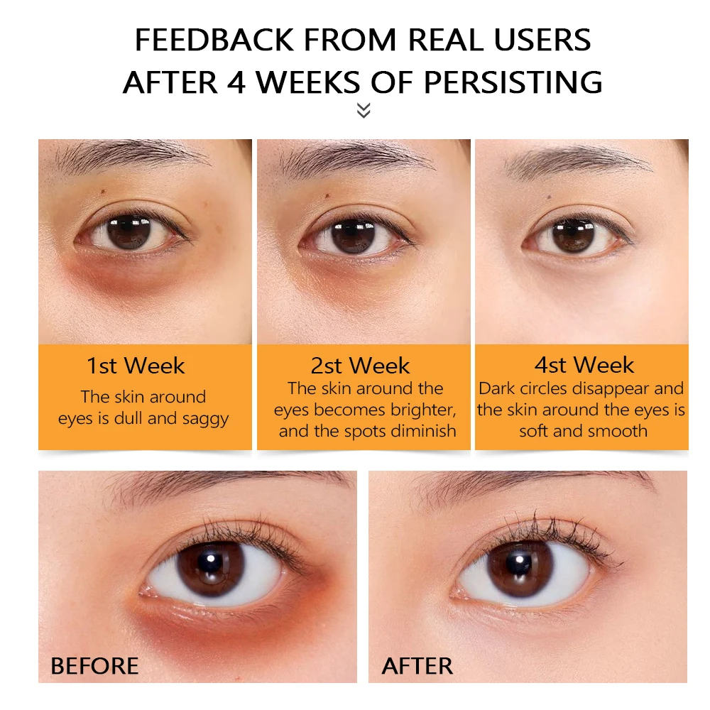 Private Label Eye Serum Vitamin C HA Nicotinamide Anti-aging Hydrating Whitening Skin Serum