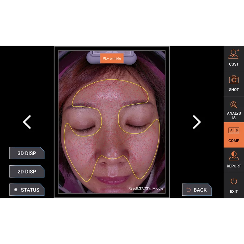 tester  diagnosis hair digital  type pigment volume 15 mp 10 care camera wireless wifi skin scalp analyzer