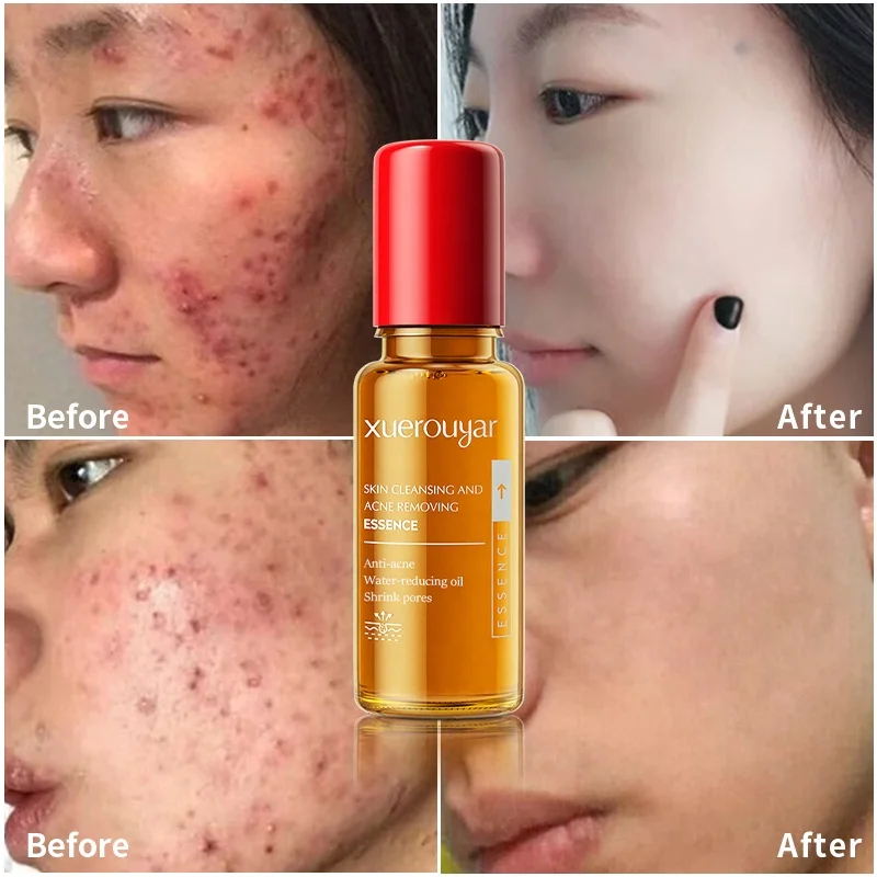 Whitening moisturizer the ordinary skin care ampoules serum beauty personal care products skin care serum organic niacinamide