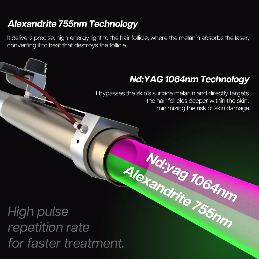 2025 Alexpulse Best Sale Dual Wavelength 755Nm 1064Nm Alexandrite Laser Hair Removal Equipment For Sale