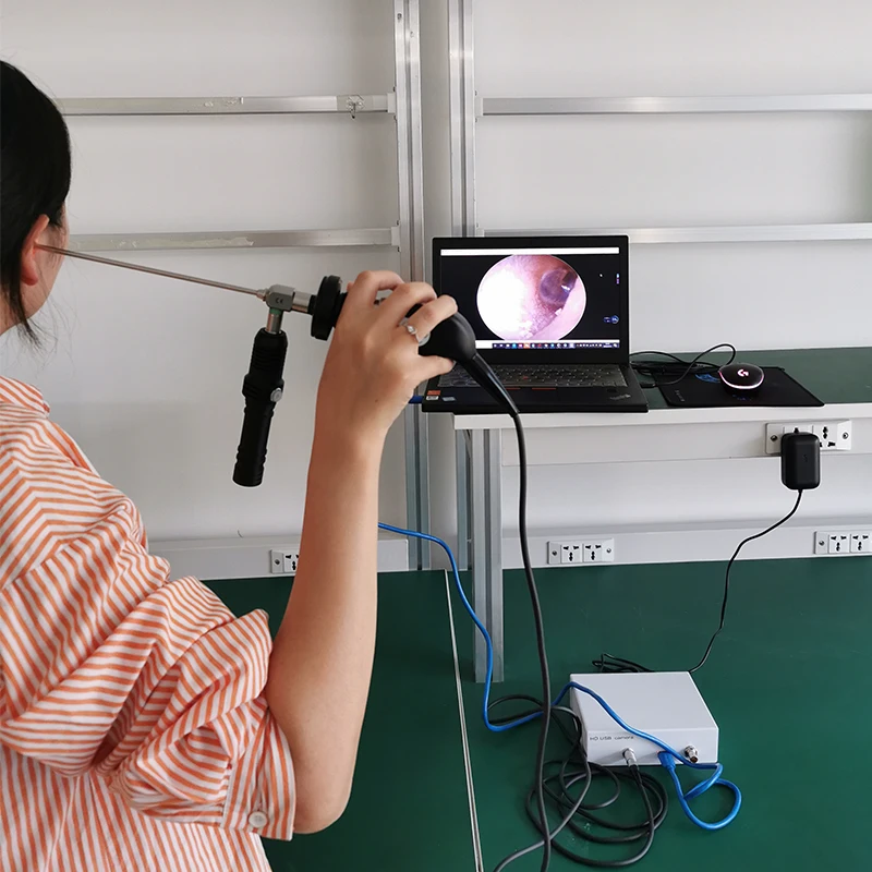 medical portable USB ear nasal scope endoscopy camera for ent surgery