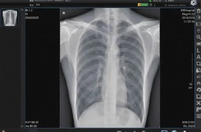 High quality 17x17in	Flat Panel Detector Digital Wireless X-Ray Machine DR RX Flat Panel Detector