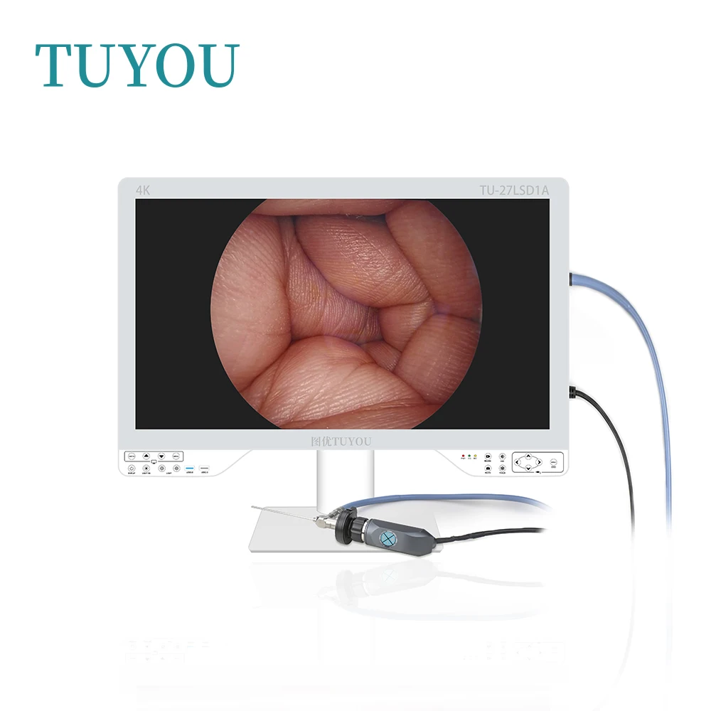 New Arrival 4 IN 1 4K USB video record function Endoscope Camera System with 80W Light Source Medical Grade Monitor
