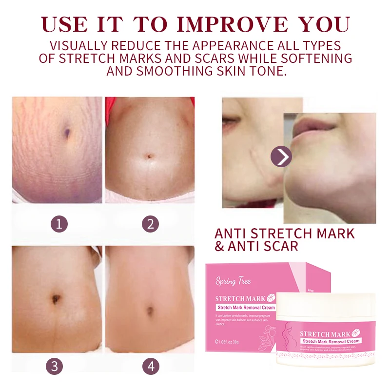 Private Label 100% Natural Vegan Anti Postpartum Deep Acne Scar Removal Stretch Mark Cream