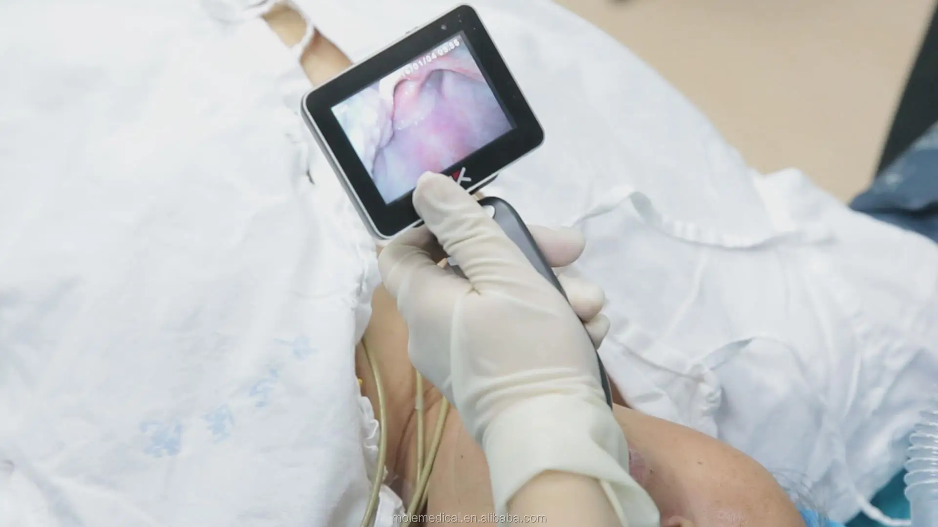 Cheap Price Medical Equipments Manufacture Anesthesia Laryngoscopy Whosale Disposable Video Laringoskop  Video Laryngoscope