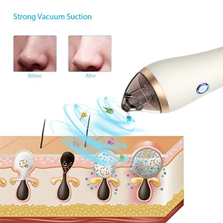 Skin Rejuvenation Dead Skin Removal Skin Care Tools Face Clean Pore Facial Blackhead Remover