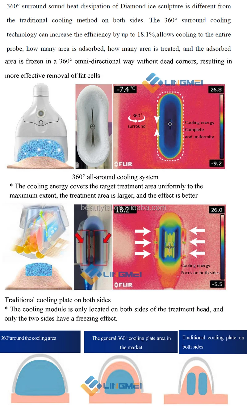 TSL-1102A cryolipolysis 7.jpg