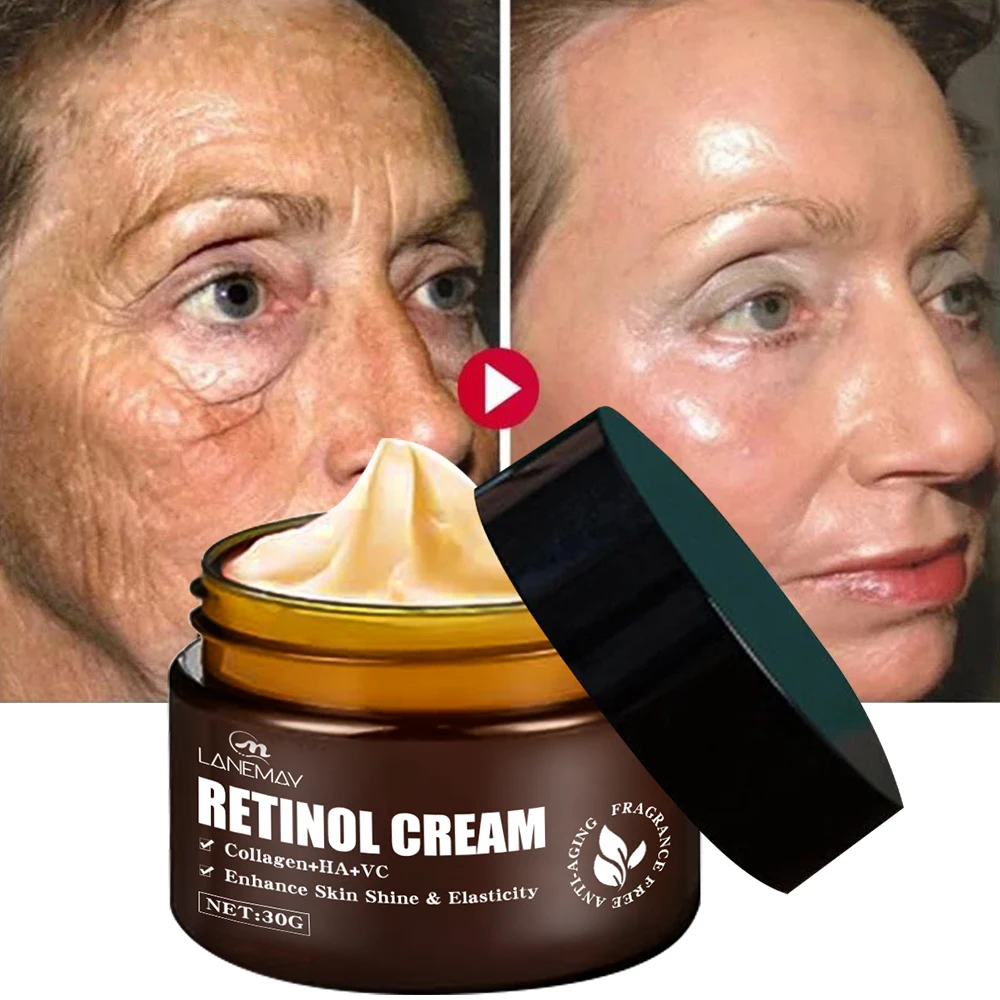 private label organic Remove Wrinkle Vitamin E Hyaluronic Acid Moisturizer anti aging 3% retinol face cream