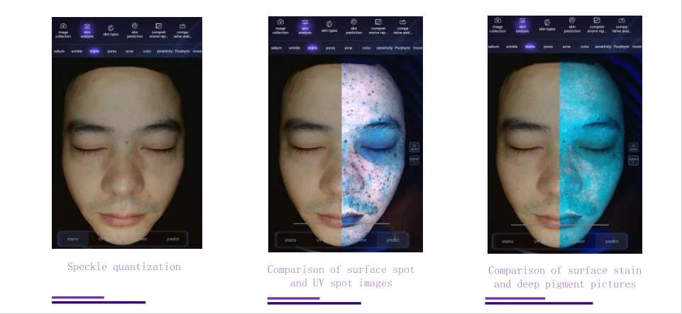 2024 Portable 3D Skin Analysis Machine Facial Uv Lcd Wifi Skin Lamp Scan Skin Analyzer Machine Face Analyzer Machine